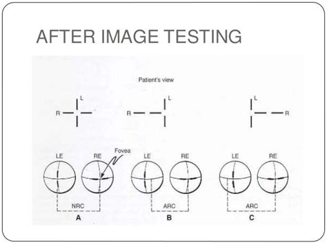 after image tests.